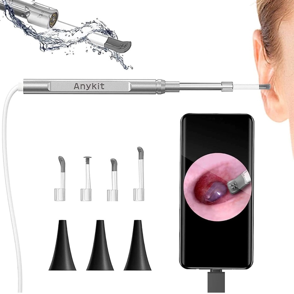 USB Ear Otoscope for PC & Android Device (NOT for iPhone/iPad), Ultra Clear View